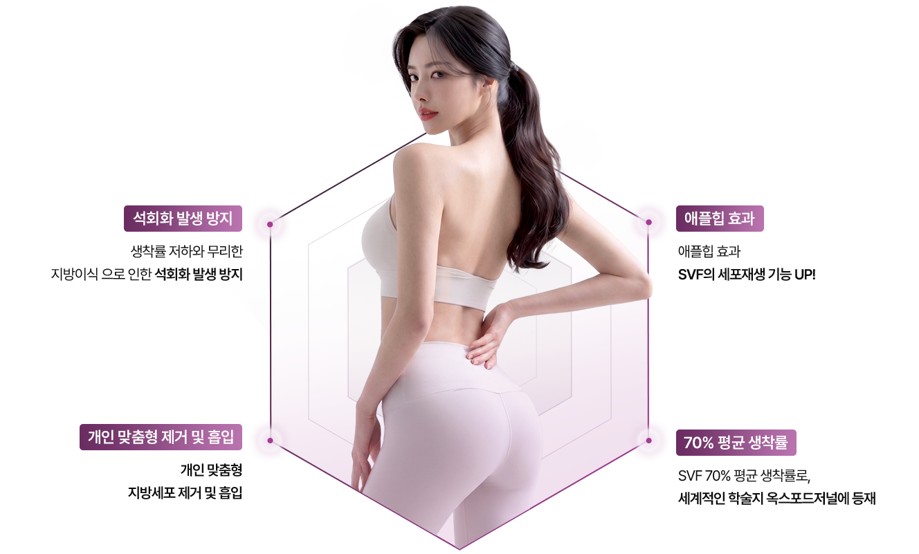 sc301의원 SVF 힙성형 장점 이미지