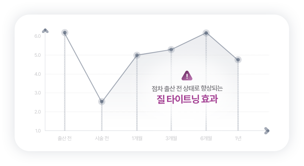 질의 탄력 상승 차트 이미지