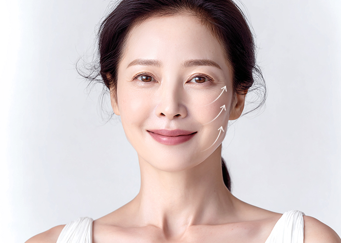 셀핏리프팅의 효과 두번째 이미지