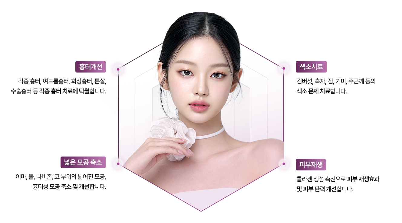 프락셀레이저 장점 이미지