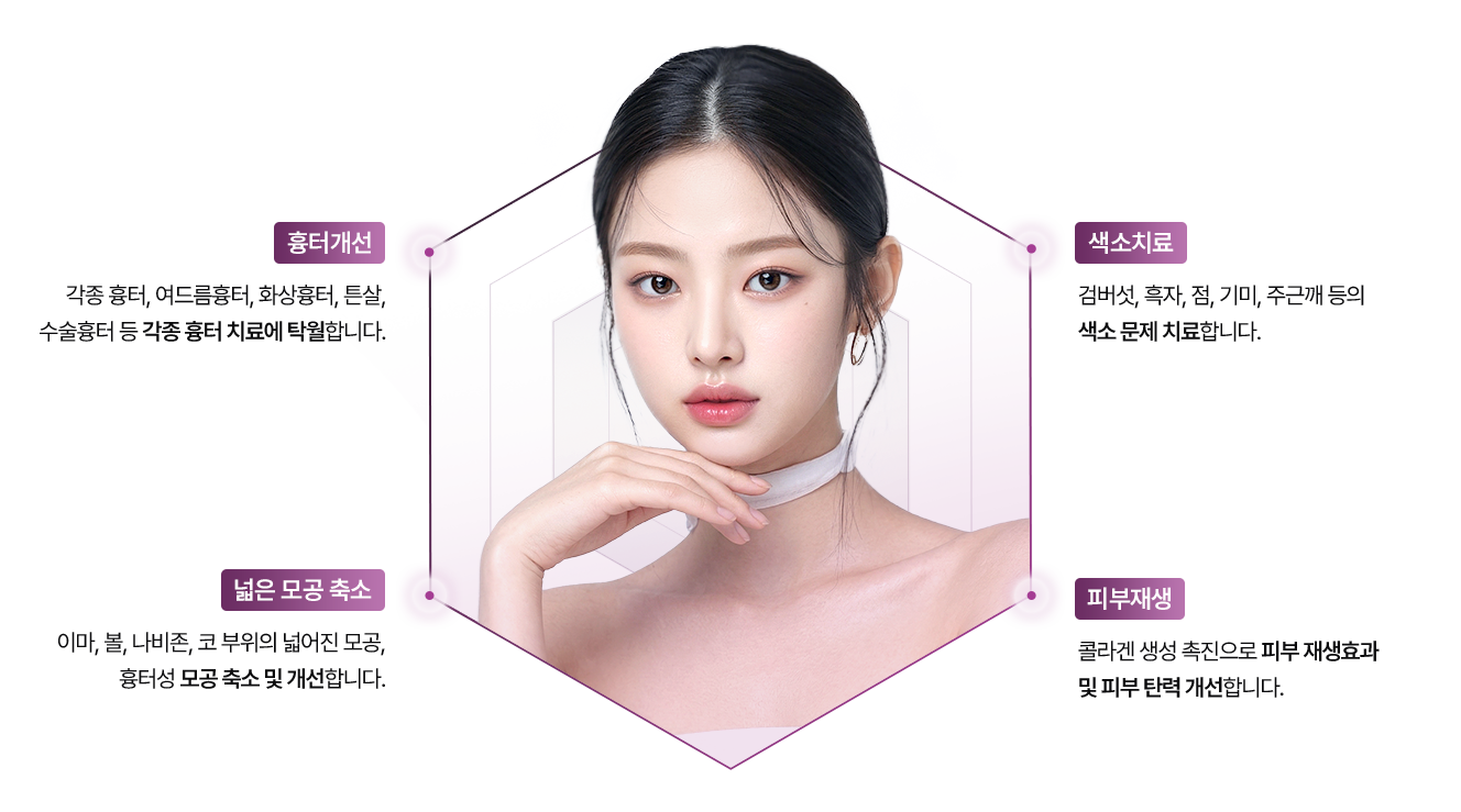 셀라스레이저 장점 이미지