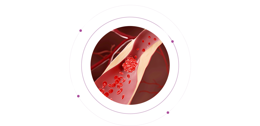 SVF 발기부전 치료 임상 실험 관련 설명 이미지