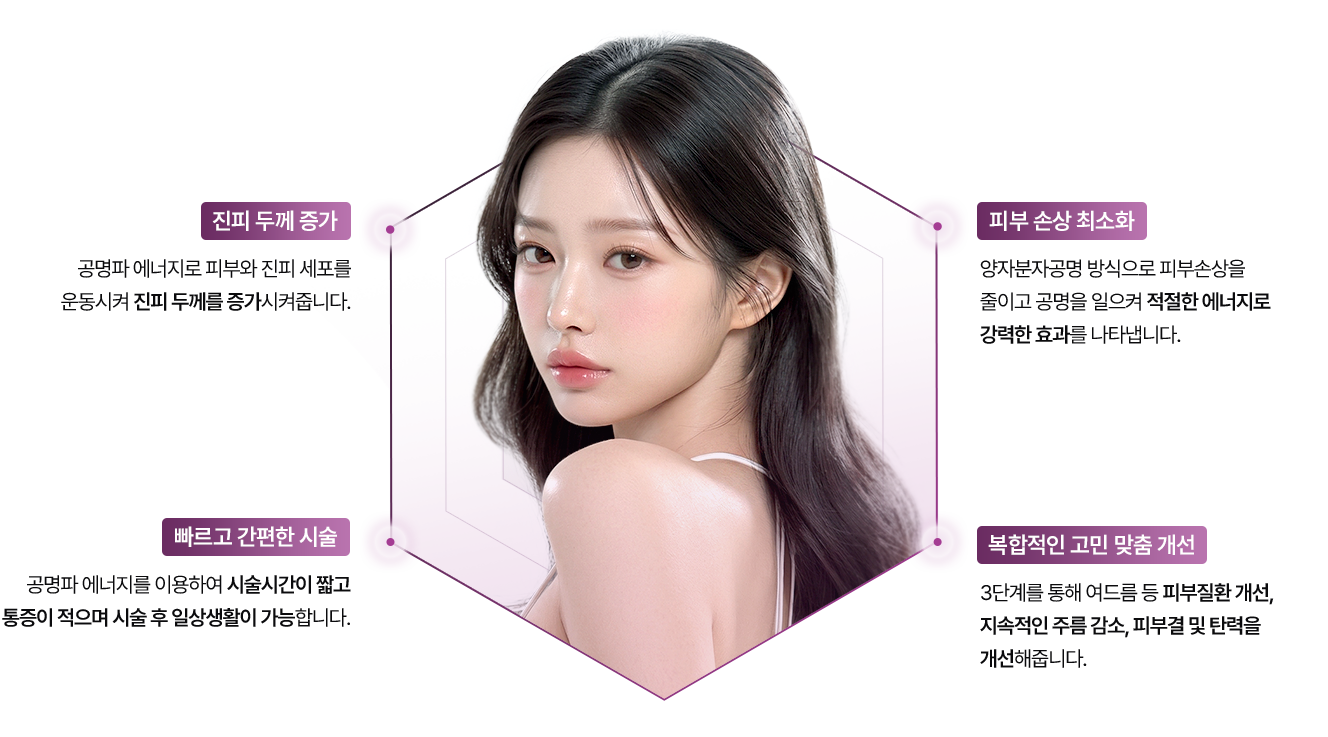 스마트 니들리프팅 장점 이미지