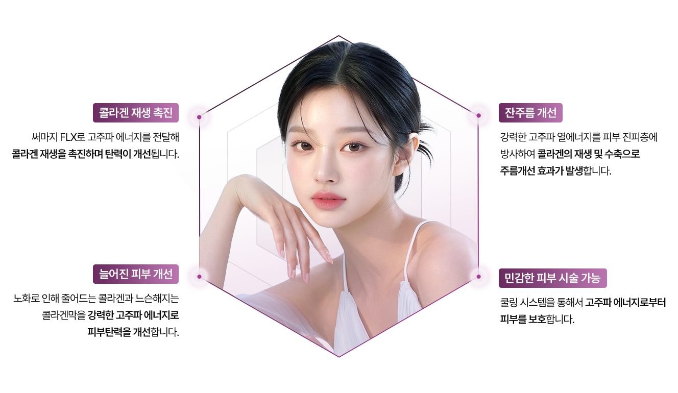 써마지 FLX 장점 이미지