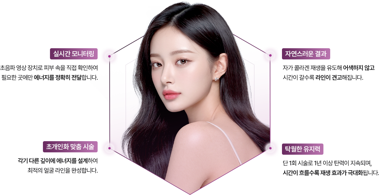 울쎄라피 프라임 장점 및 특징 이미지