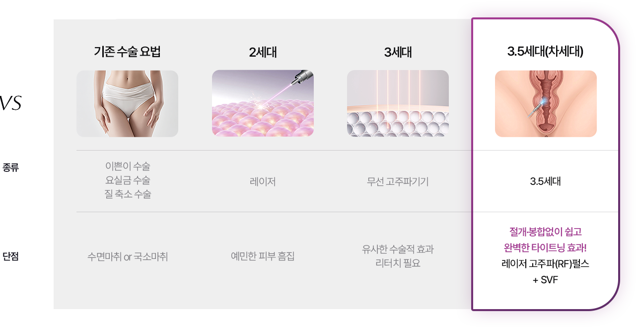 SC301만의 3.5세대 질성형 비교분석 이미지
